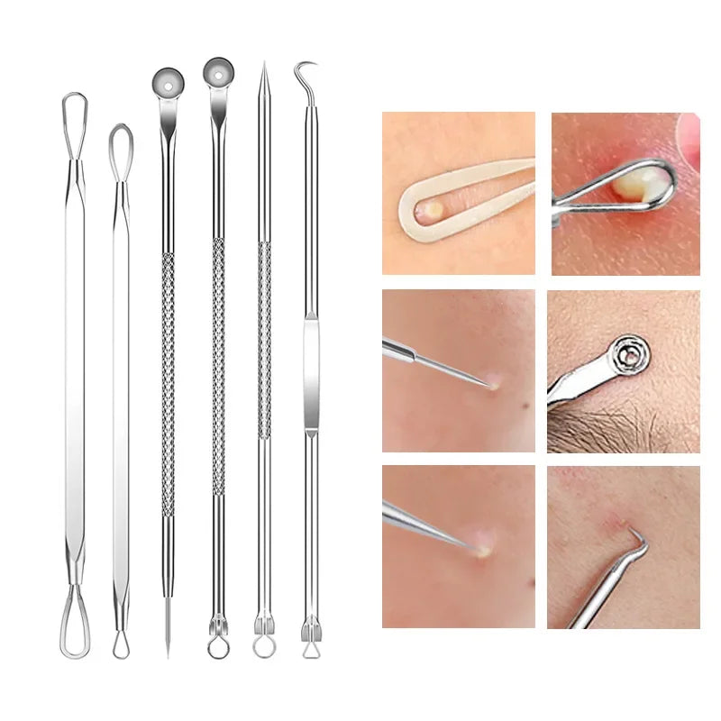 Blackhead & Ingrown Hair Removal Tool Set (4-11pcs)
