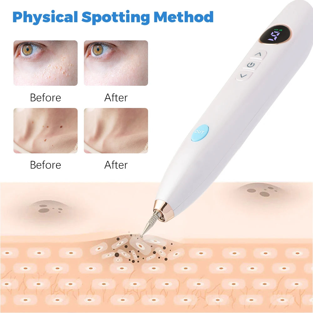 Professional Plasma Pen 9-level skin freckle remover
