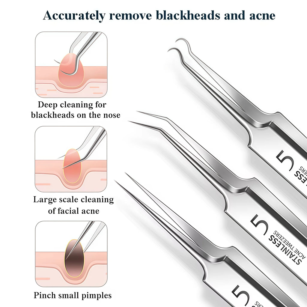 Blackhead & Ingrown Hair Removal Tool Set (4-11pcs)